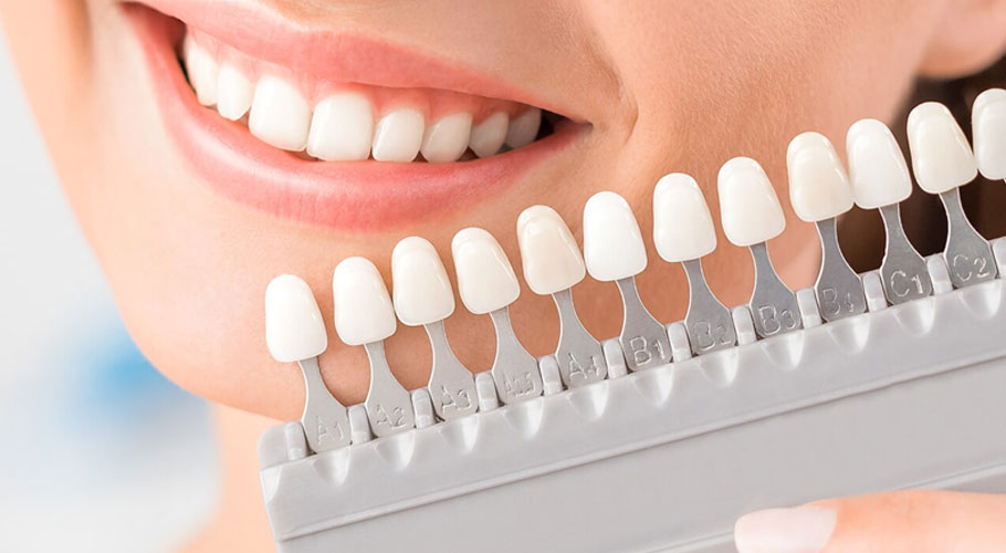 Parcours de conception de sourire